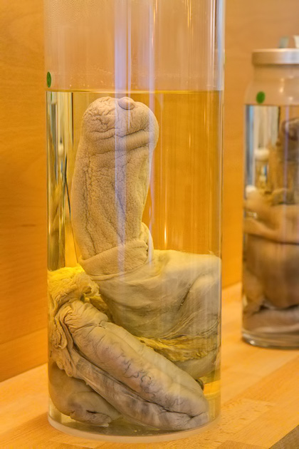Human Phallus Pictures